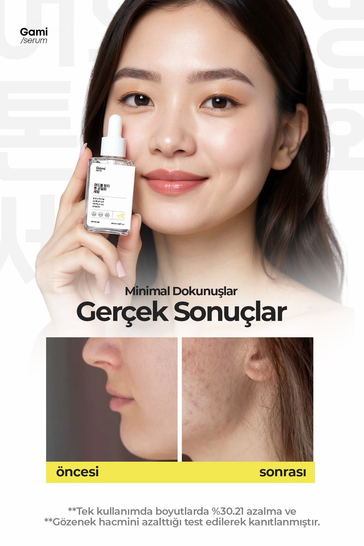 Leke Karşıtı ve Ton Eşitleyici Serum