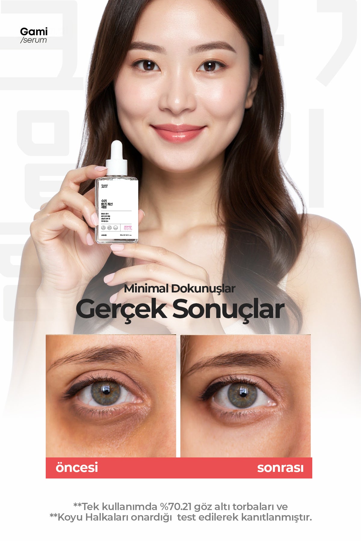 Göz Altı Torbaları ve Koyu Halka Karşıtı Serum