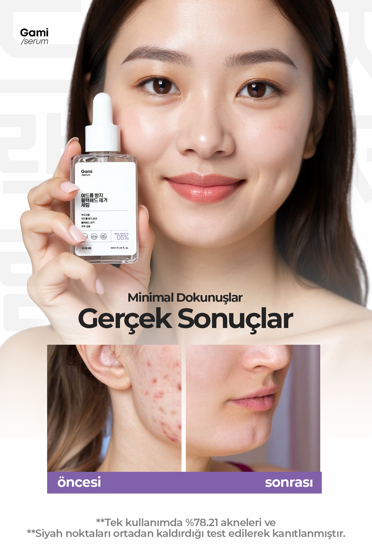 Sivilce ve Siyah Nokta Karşıtı Serum